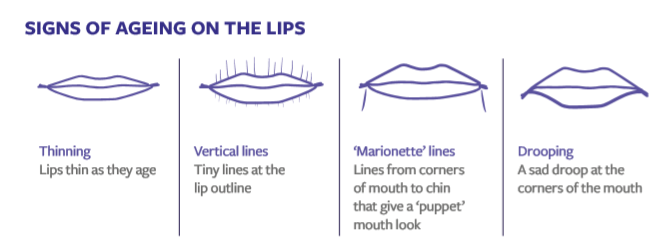 lip fillers near me hemel hempstead