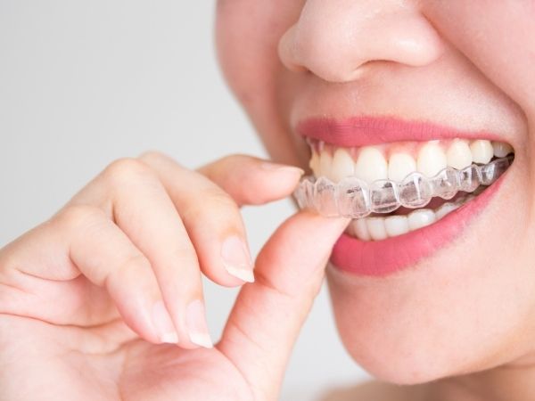invisalign hemel hempstead