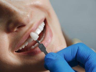 Composite Bonding