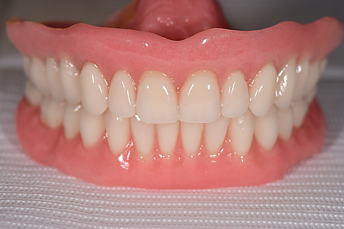 The set of dentures made in advance to test and agree the proposed new teeth